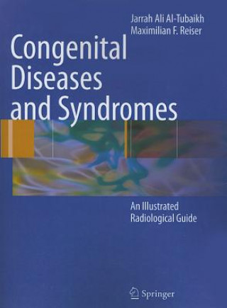 Carte Congenital Diseases and Syndromes Jarrah Ali Al-Tubaikh