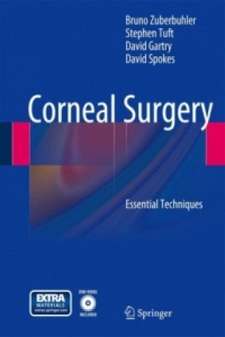 Book Corneal Surgery Bruno Zuberbuhler