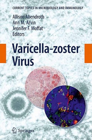Kniha Varicella-zoster Virus Allison Abendroth
