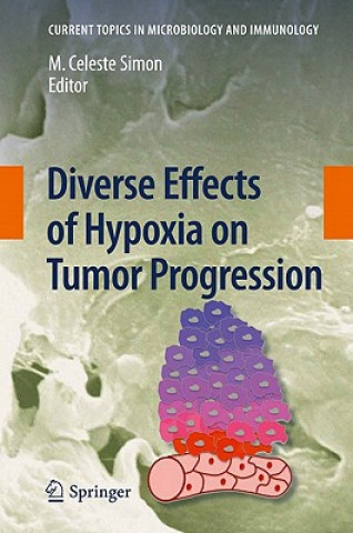 Carte Diverse Effects of Hypoxia on Tumor Progression M. Celeste Simon