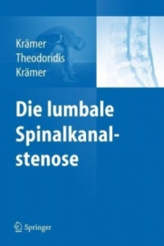 Könyv Die lumbale Spinalkanalstenose Robert Krämer
