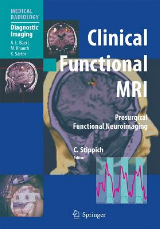 Carte Clinical Functional MRI Christoph Stippich
