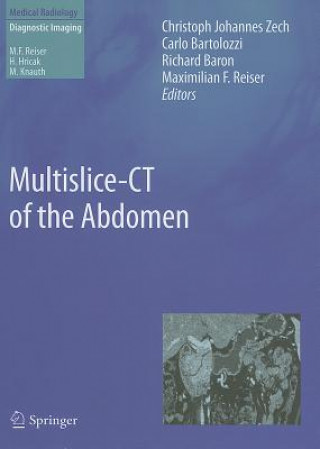 Kniha Multislice-CT of the Abdomen Christoph J. Zech