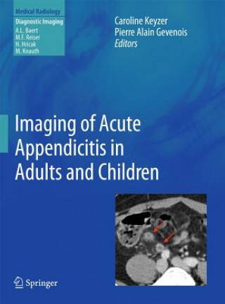 Kniha Imaging of Acute Appendicitis in Adults and Children Caroline Keyzer