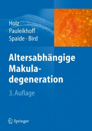Carte Altersabhangige Makuladegeneration Frank G. Holz