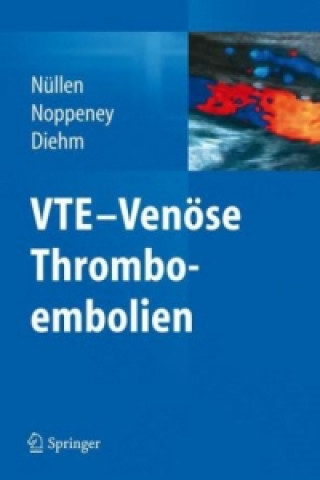 Könyv VTE - Venose Thromboembolien Helmut Nüllen