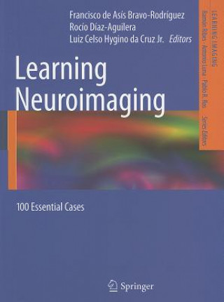 Carte Learning Neuroimaging Francisco de Asís Bravo-Rodriguez