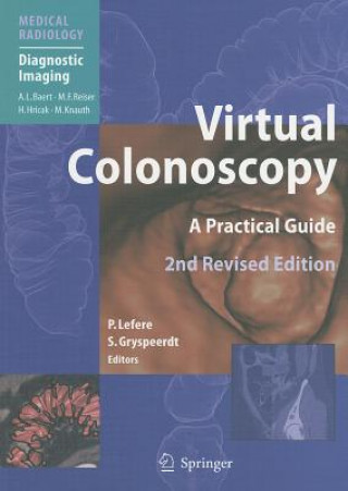 Kniha Virtual Colonoscopy Philippe Lefere