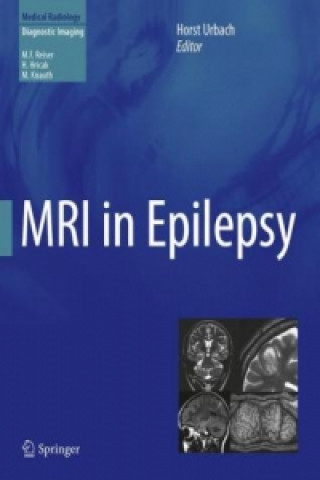 Knjiga MRI in Epilepsy Horst Urbach