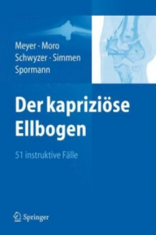Kniha Der kapriziose Ellbogen Rainer-Peter Meyer