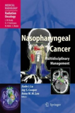 Knjiga Nasopharyngeal Cancer Jiade J. Lu