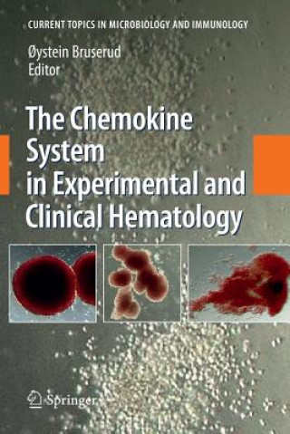 Carte Chemokine System in Experimental and Clinical Hematology Oystein Bruserud