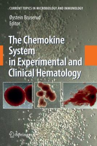 Kniha Chemokine System in Experimental and Clinical Hematology Oystein Bruserud