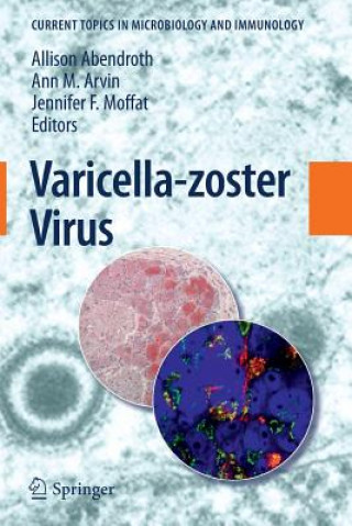 Kniha Varicella-zoster Virus Allison Abendroth