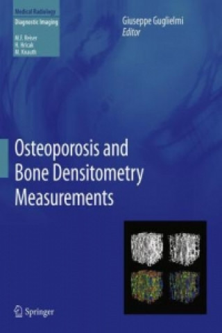 Könyv Osteoporosis and Bone Densitometry Measurements Giuseppe Guglielmi
