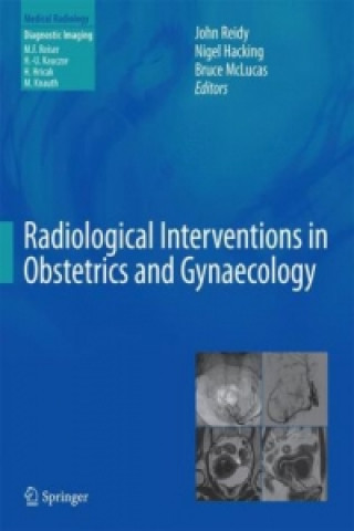 Könyv Radiological Interventions in Obstetrics and Gynaecology John Reidy