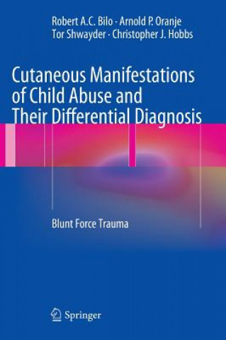 Knjiga Cutaneous Manifestations of Child Abuse and Their Differential Diagnosis Robert A. C. Bilo