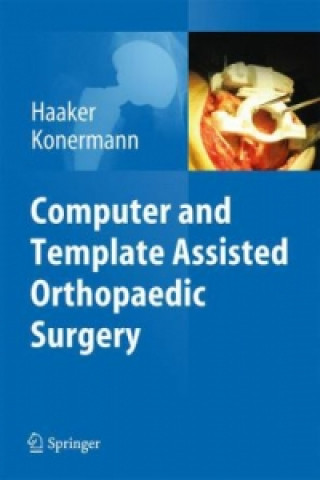 Książka Computer and Template Assisted Orthopedic Surgery Rolf Haaker