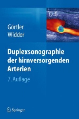 Könyv Duplexsonographie der hirnversorgenden Arterien, m. 1 Buch, m. 1 E-Book Bernhard Widder