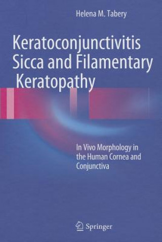 Knjiga Keratoconjunctivitis Sicca and Filamentary Keratopathy Helena M. Tabery