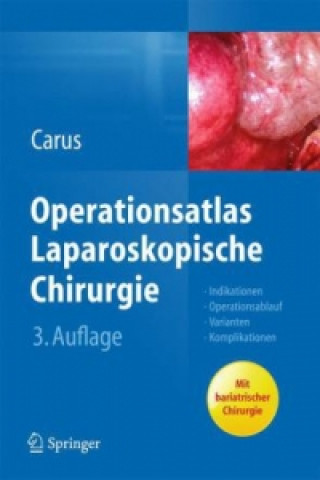 Kniha Operationsatlas Laparoskopische Chirurgie Thomas Carus