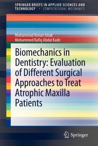 Kniha Biomechanics in Dentistry: Evaluation of Different Surgical Approaches to Treat Atrophic Maxilla Patients Muhammad Ikman Ishak