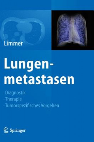 Kniha Lungenmetastasen Stefan Limmer