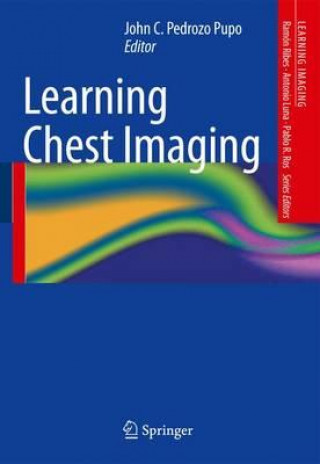Книга Learning Chest Imaging John C. Pedrozo Pupo