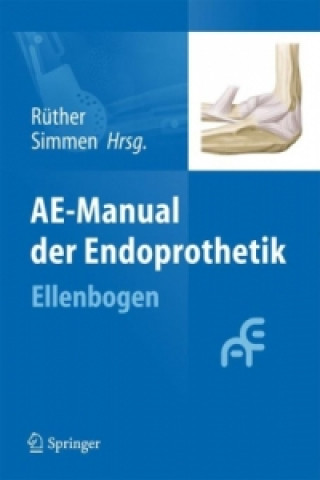 Kniha AE-Manual der Endoprothetik Wolfgang Rüther