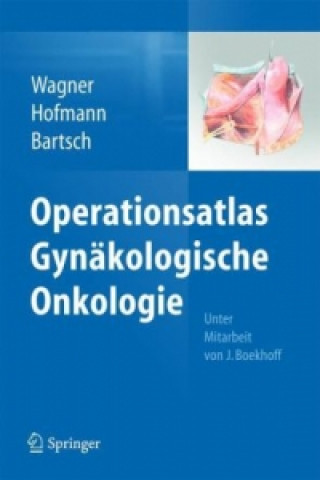 Könyv Operationsatlas Gynakologische Onkologie Uwe Wagner