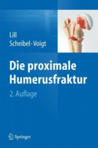Könyv Die proximale Humerusfraktur Helmut Lill