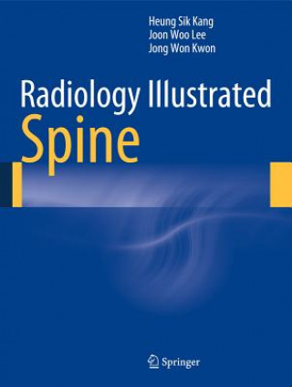 Kniha Radiology Illustrated: Spine Heung Sik Kang