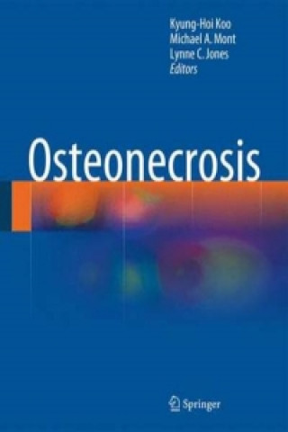 Carte Osteonecrosis Kyung-Hoi Koo