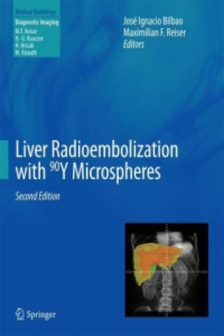 Carte Liver Radioembolization with 90Y Microspheres José Ignacio Bilbao