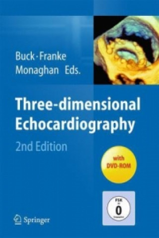 Книга Three-dimensional Echocardiography Thomas Buck