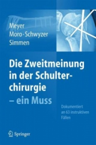 Kniha Die Zweitmeinung in der Schulterchirurgie Fabrizio Moro
