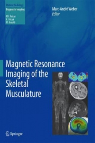 Carte Magnetic Resonance Imaging of the Skeletal Musculature Marc-André Weber