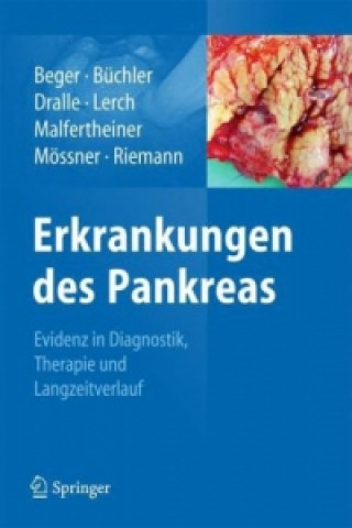 Kniha Erkrankungen des Pankreas Hans Günther Beger