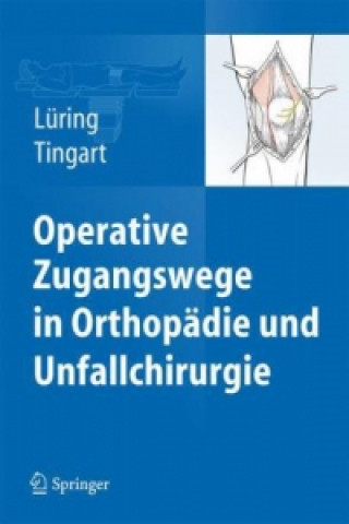 Kniha Operative Zugangswege in Orthopadie und Unfallchirurgie Christian Lüring