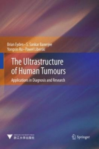 Carte Ultrastructure of Human Tumours Brian Eyden