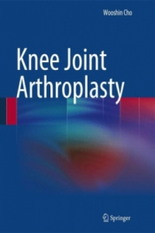 Carte Knee Joint Arthroplasty Wooshin Cho