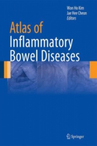 Książka Atlas of Inflammatory Bowel Diseases Won Ho Kim