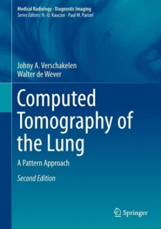 Kniha Computed Tomography of the Lung Johny A. Verschakelen