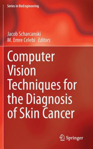 Carte Computer Vision Techniques for the Diagnosis of Skin Cancer Jacob Scharcanski