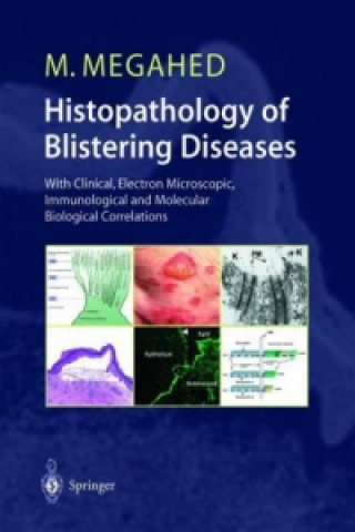 Kniha Histopathology of Blistering Diseases Mosaad Megahed