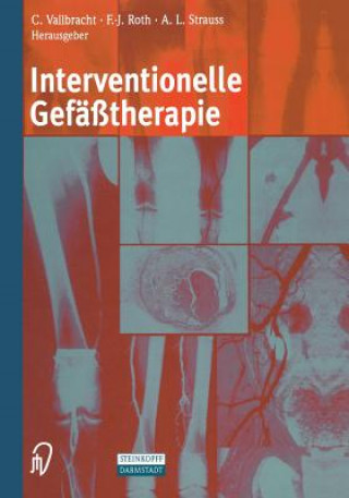 Kniha Interventionelle Gefäßtherapie C. Vallbracht