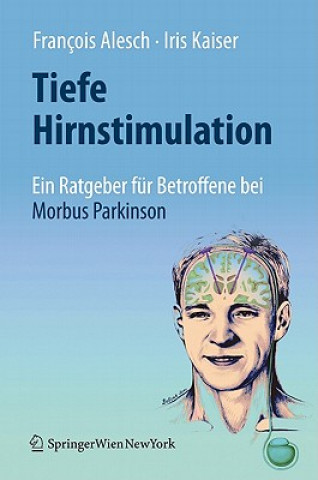 Kniha Tiefe Hirnstimulation: Ein Ratgeber fur Betroffene bei Morbus Parkinson François Alesch