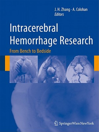 Carte Intracerebral Hemorrhage Research John Zhang