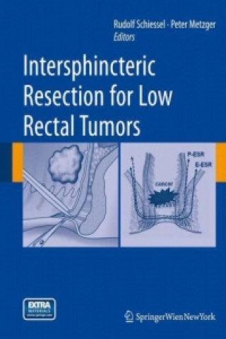 Книга Intersphincteric Resection for Low Rectal Tumors Rudolf Schiessel