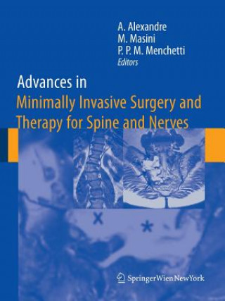 Könyv Advances in Minimally Invasive Surgery and Therapy for Spine and Nerves Alberto Alexandre
